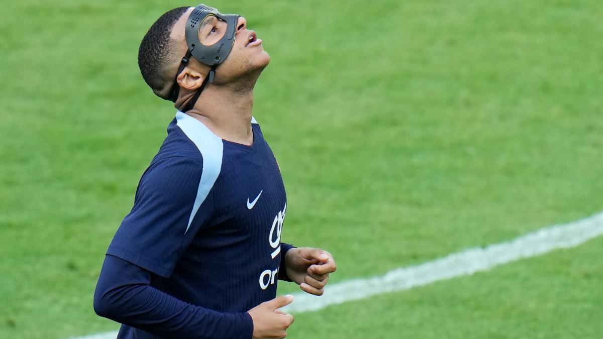Deschamps: "Mbappé corre el riesgo de tener que llevar la máscara varios meses"