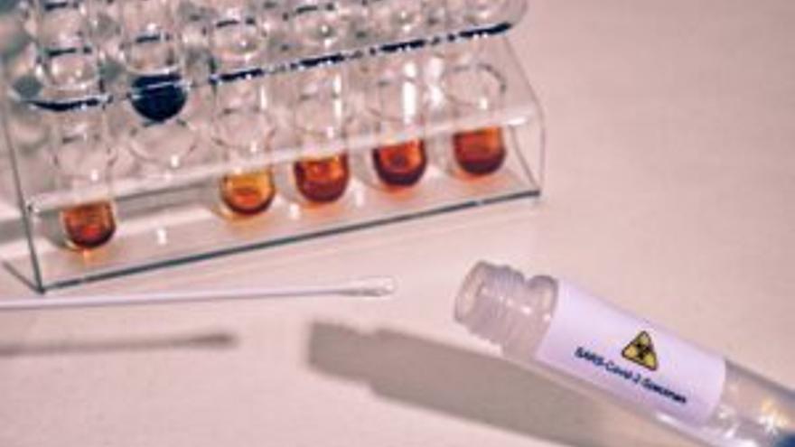 Una PCR «made in spain» elimina los falsos positivos por coronavirus