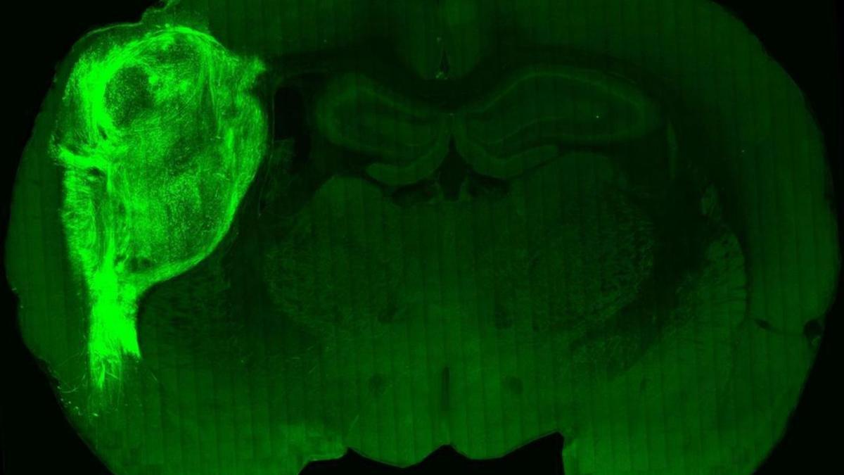 Imatge del minicervell de cèl·lules humanes trasplantat a una rata | UNIVERSITAT DE STANFORD
