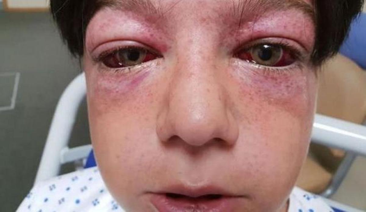 Tyler Broome, tras hacer el 'Rondabout of Death'.