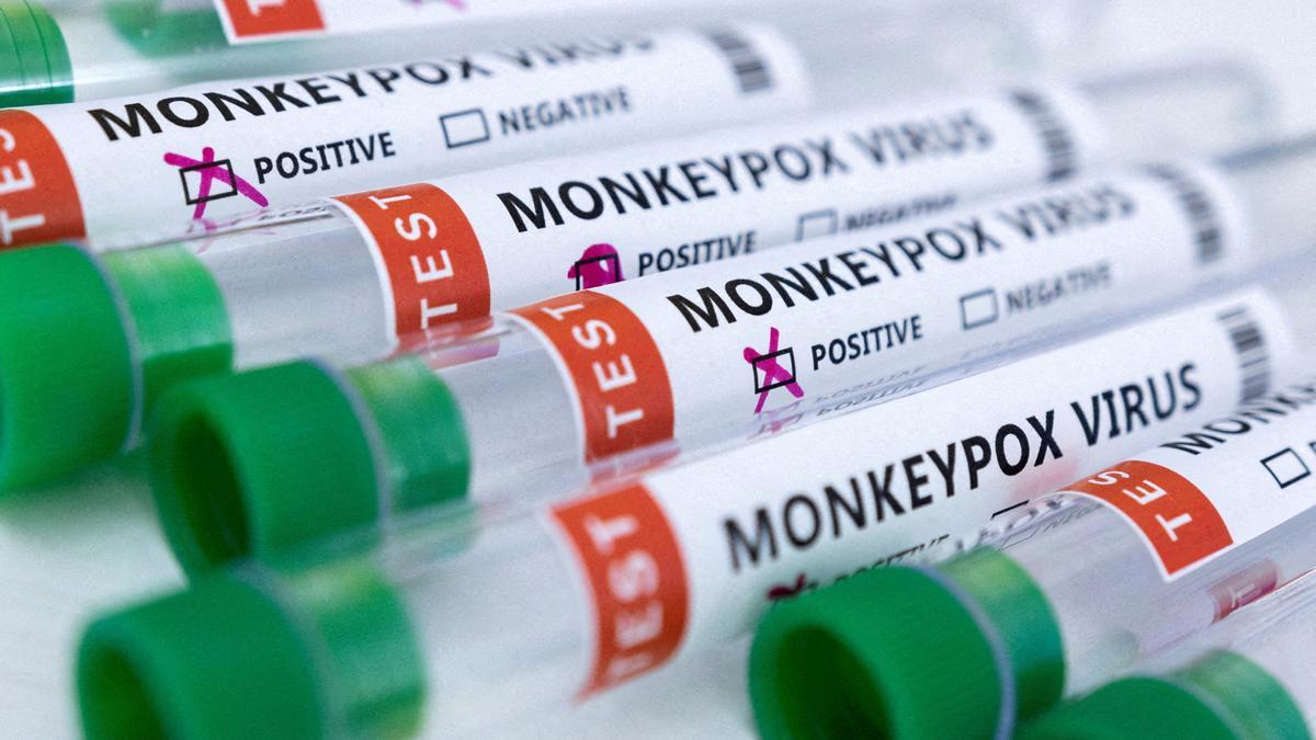 Tubos con etiquetas de la viruela del mono, ahora mpox.