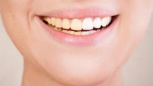 Dientes