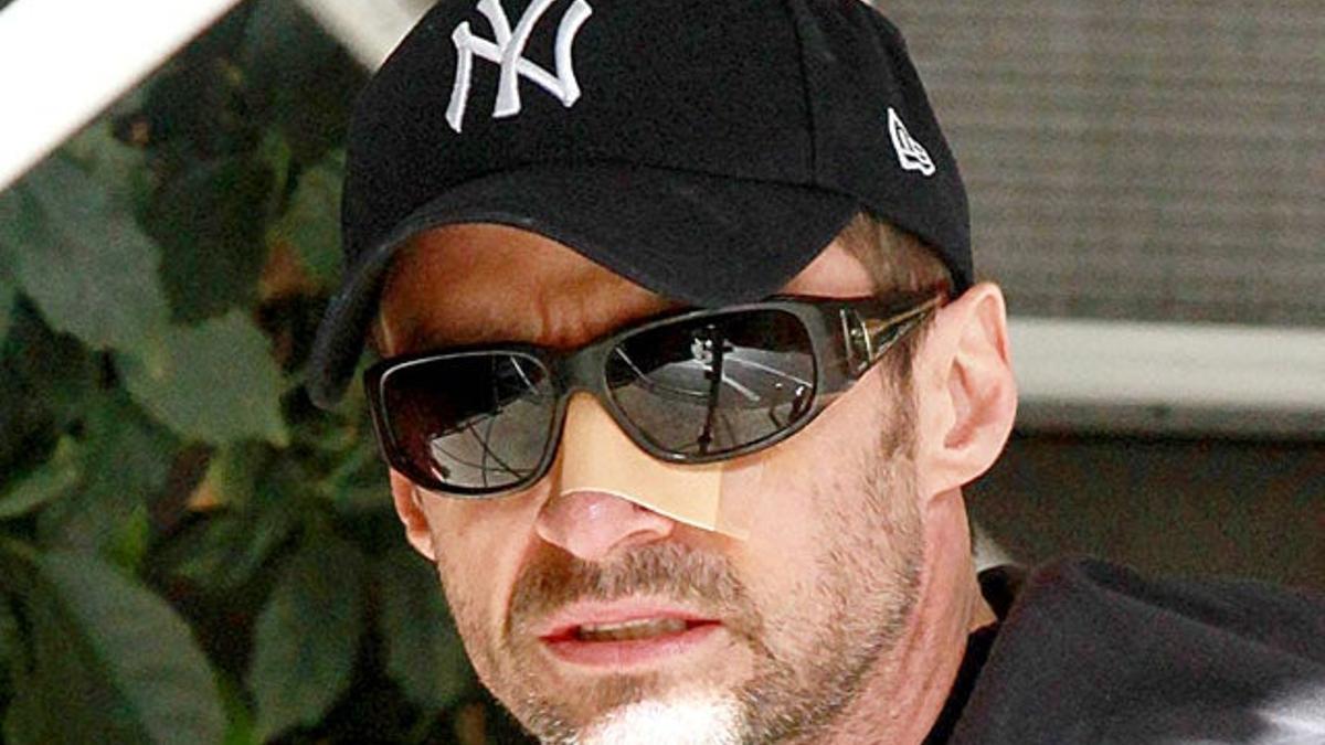 Hugh Jackman operado por tercera vez de su cáncer de piel