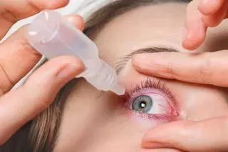 Conjuntivitis alérgica: síntomas y receta del especialista para un problema ocular que se dispara en verano