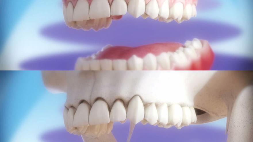 Una imagen de modelos de dentaduras.