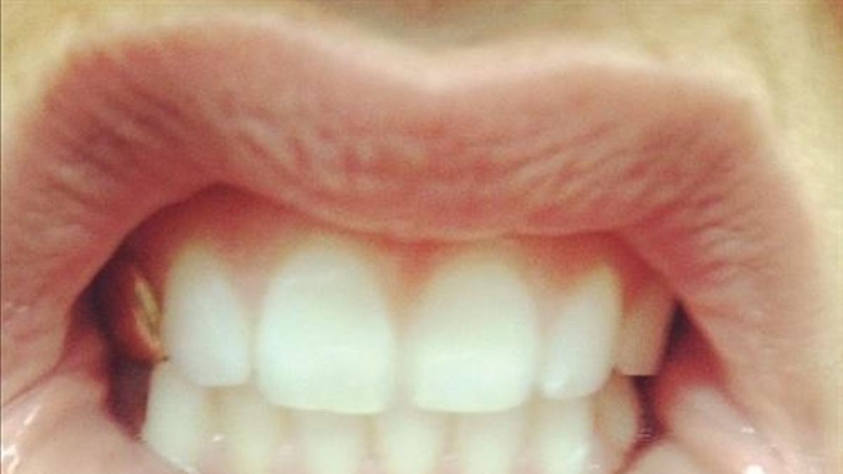 Kesha estrena tatuaje en la boca