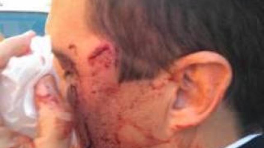 Brutal agresión a un policía por el dueño de un perro sin bozal