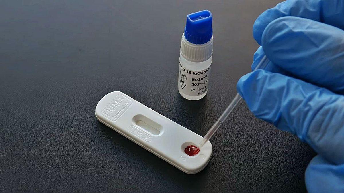 Desarrollan en València un test súper sensible para detectar anticuerpos del coronavirus