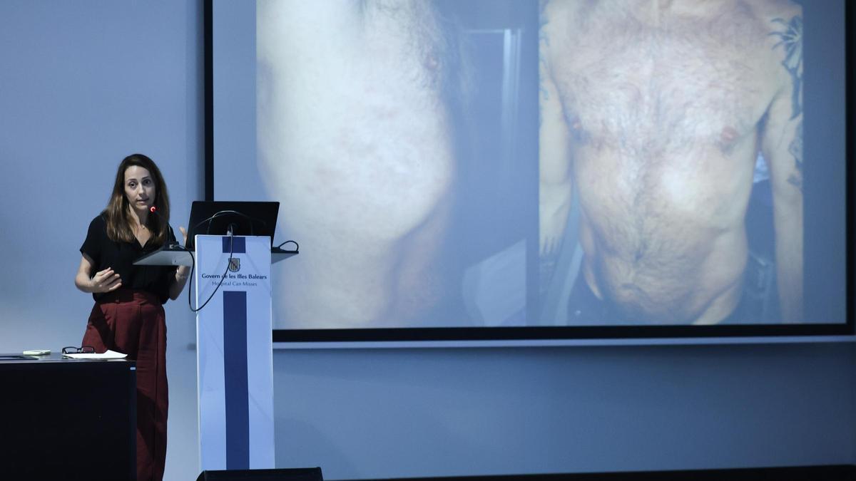 Galería: Jornada sobre enfermedades de transmisión sexual en Can Misses