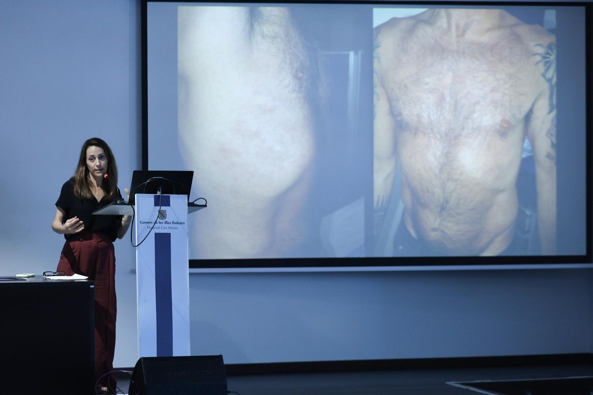 La percepción de riesgo por contraer una ETS deja de existir en el 'chemsex'