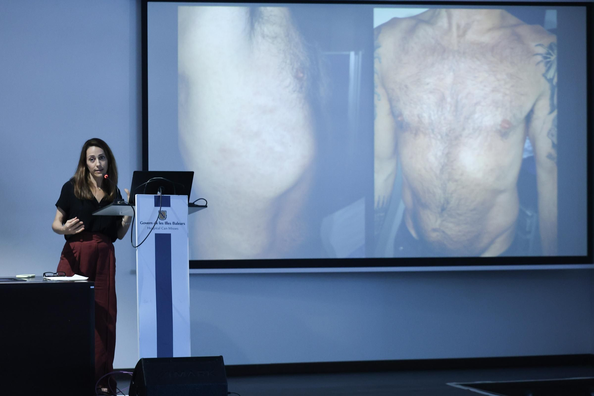 Galería: Jornada sobre enfermedades de transmisión sexual en Can Misses