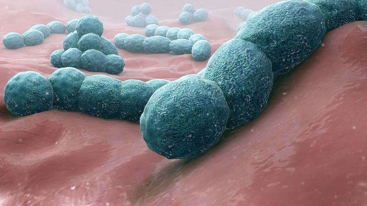 La bacteria Streptococcus pneumoniae causa meningitis.