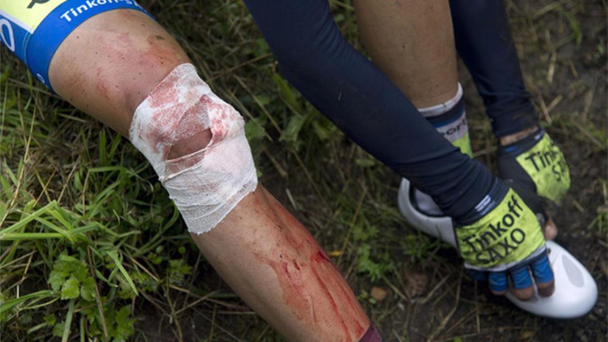 Contador se fracturó la tibia en el Tour de Francia.