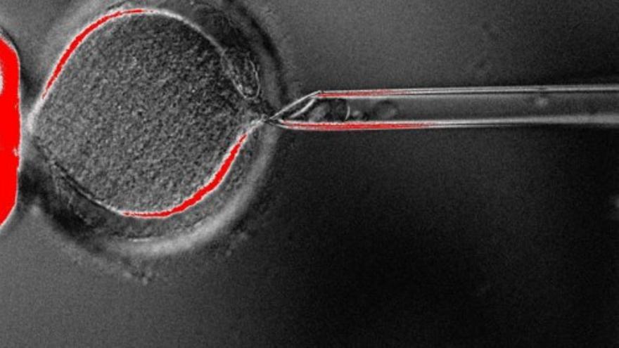 Científicos logran clonar células madre humanas