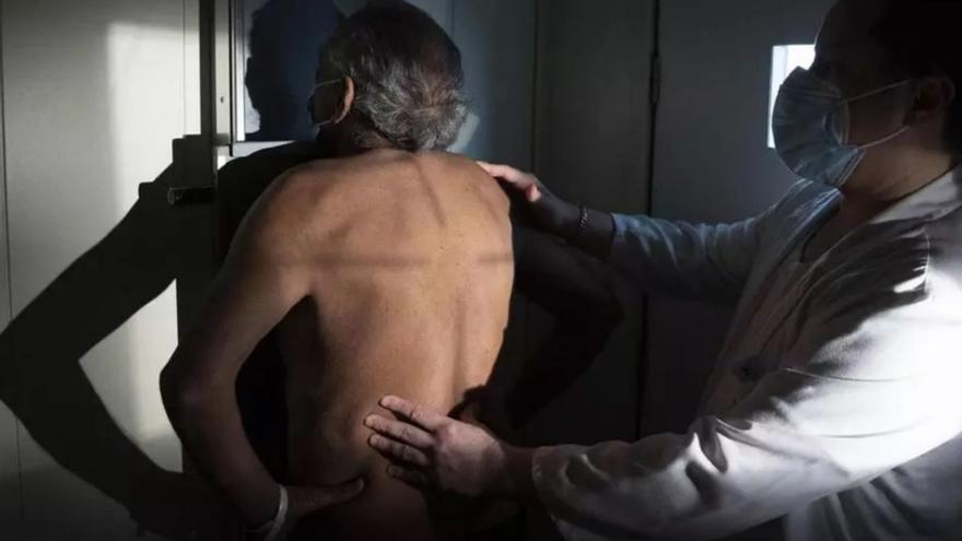 Un médico prepara a un paciente de tuberculosis para una radiografía de tórax.