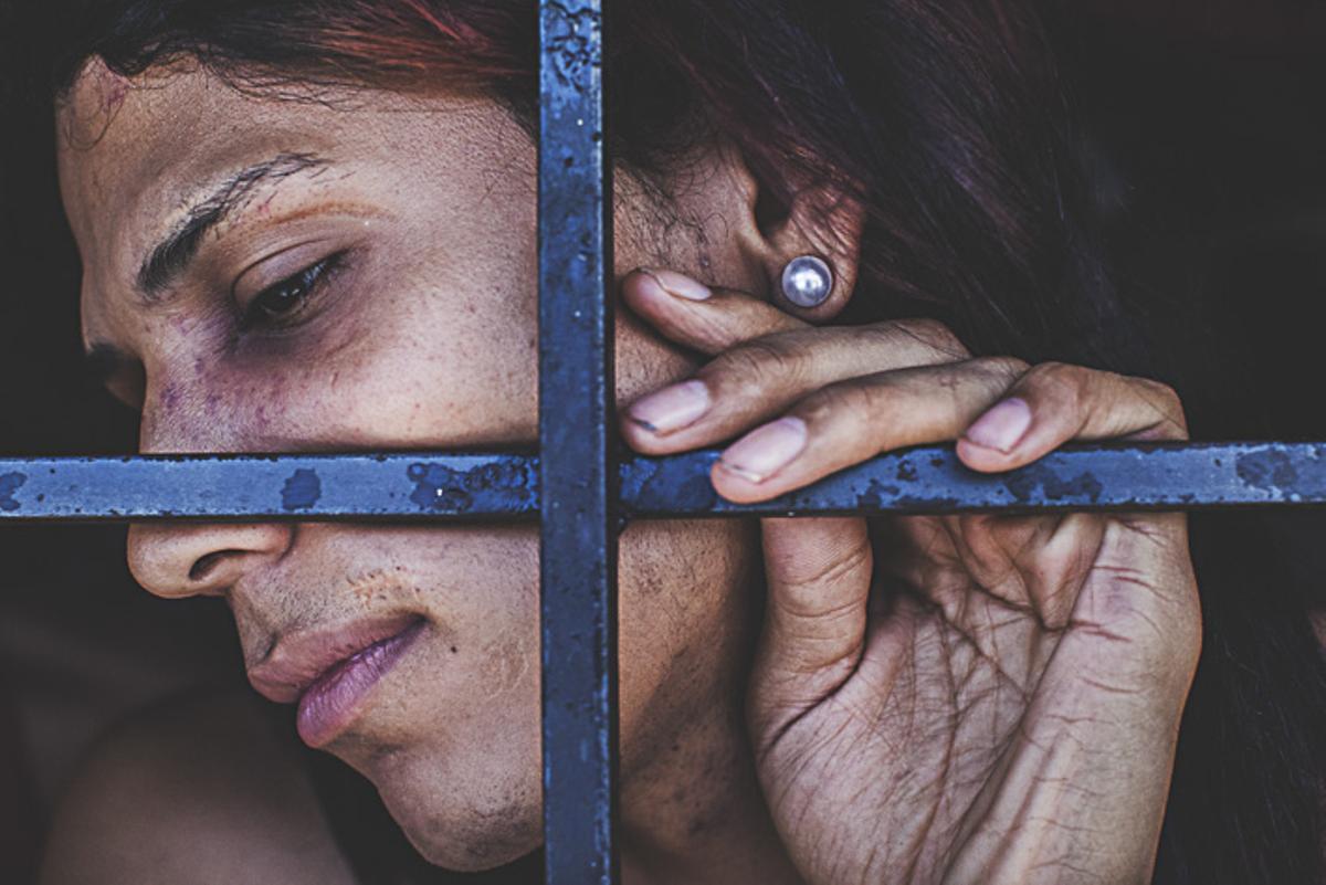 Una mujer transgénero muestra sus heridas y cicatrices a través de los barrotes de su celda en enero de 2017 en Poli-Valencia, Venezuela.