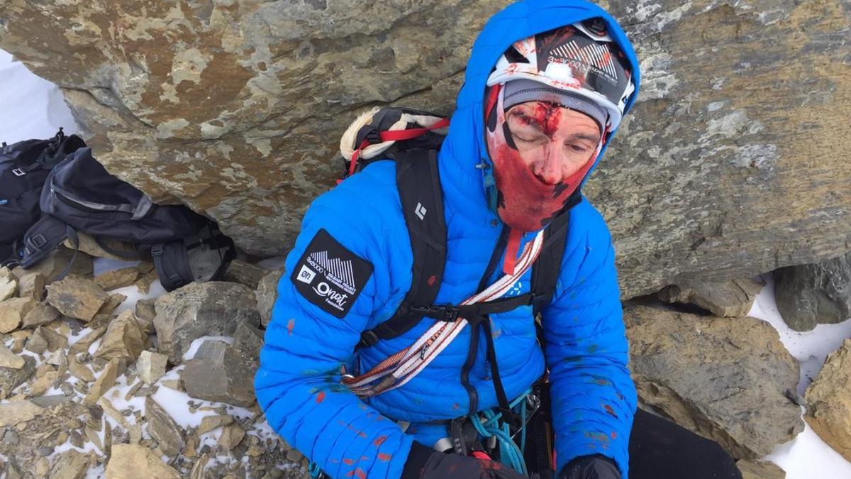 Sergi Mingote, tras sufrir el accidente en el pico Taillón