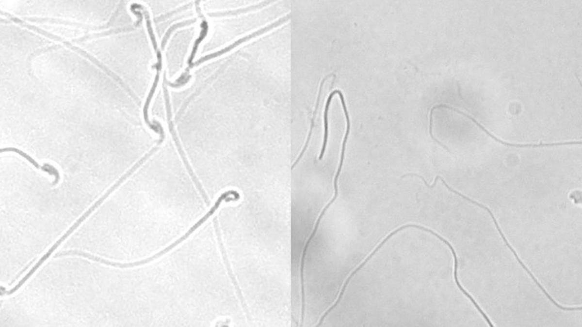Imágenes del microscopio que muestran claramente la diferencia en los espermatozoides.