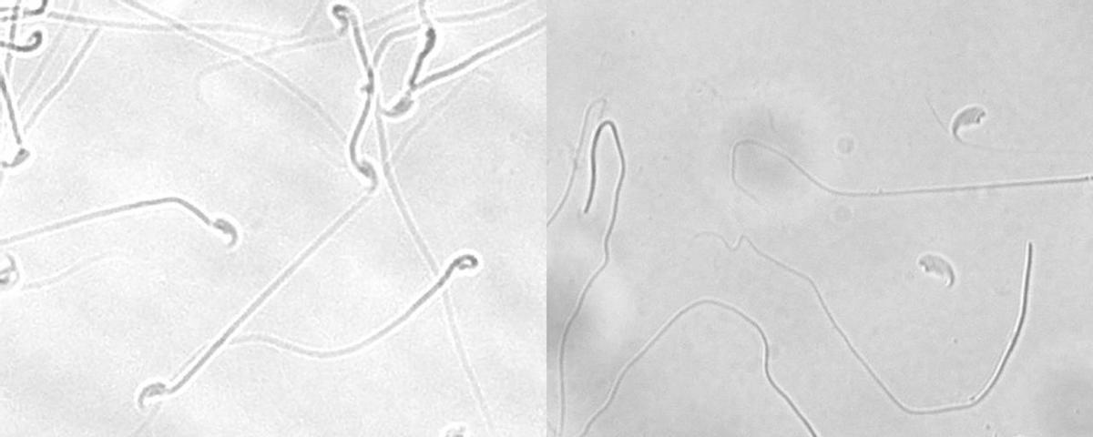 Imágenes del microscopio que muestran claramente la diferencia en los espermatozoides.