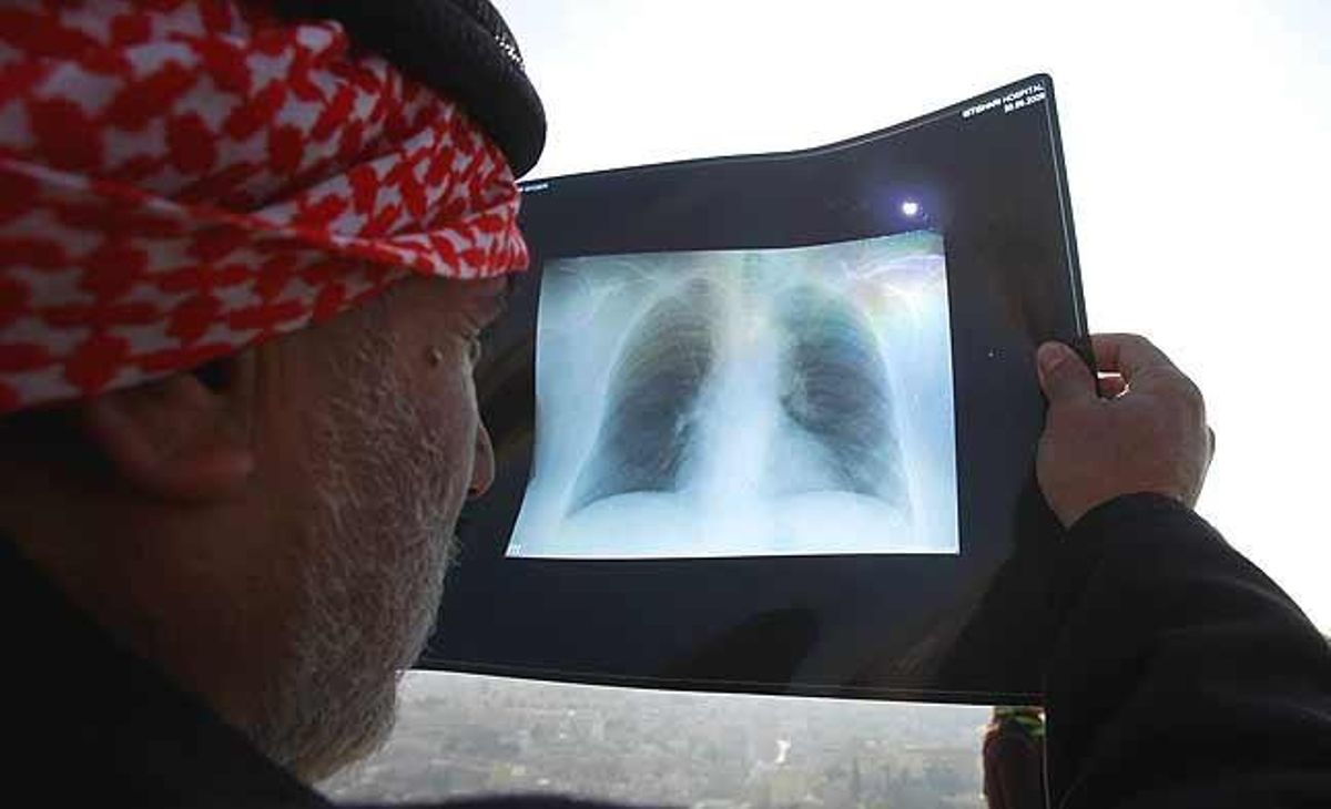 Un home jordà recorre al popular mètode de la radiografia per observar l’eclipsi a Amman (Jordània).
