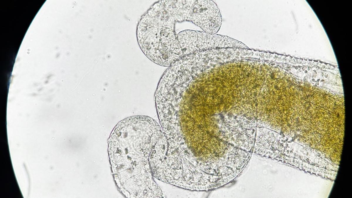 Un parásito, bajo microscopio.