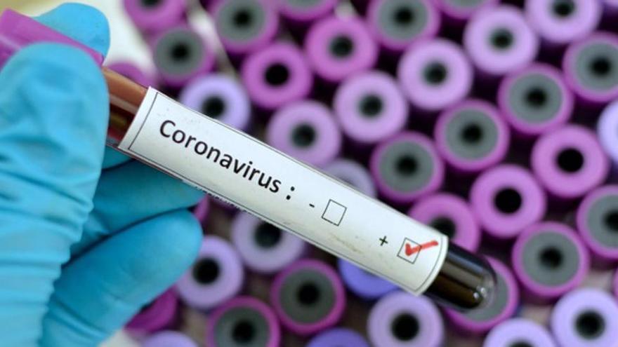 Brasil supera los siete millones de casos por el nuevo coronavirus