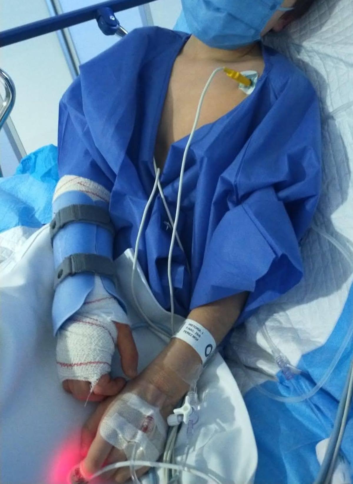 Pablo, de 7 años, tras una de sus intervenciones quirúrgicas después del accidente.