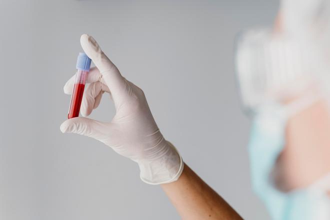 Espanya aprova el finançament de dues indicacions de glofitamab, una teràpia per a un tipus de limfoma agressiu i de creixement ràpid