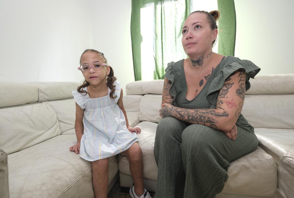 Briana Trujillo, la pequeña canaria con una enfermedad rara en la piel