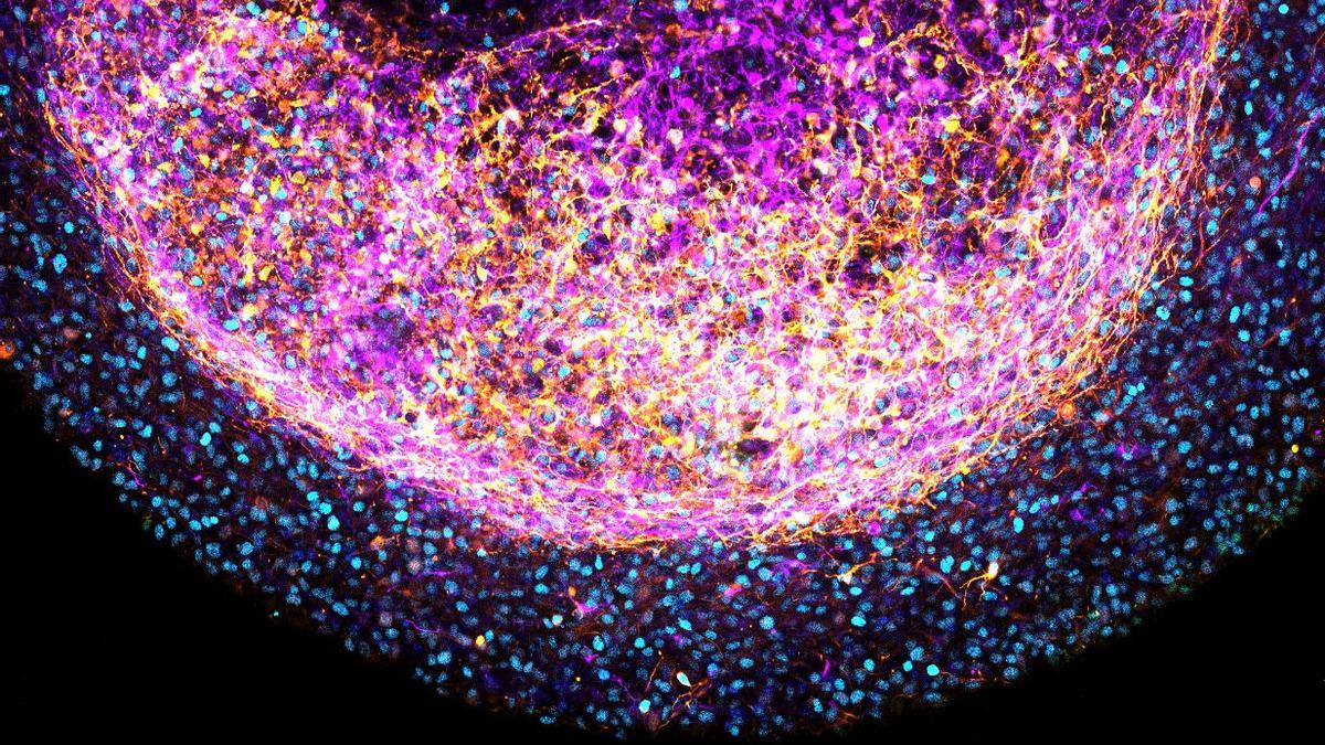 Imagen de los 'mini cerebros' creados a partir del tejido cerebral de fetos abortados