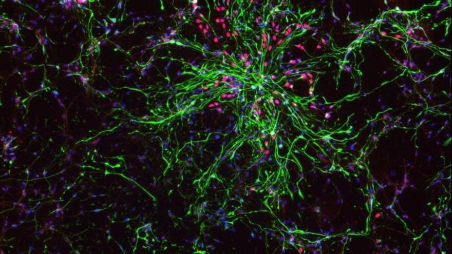 Scoprono come le cellule staminali del cervello decidono quali neuroni produrre
