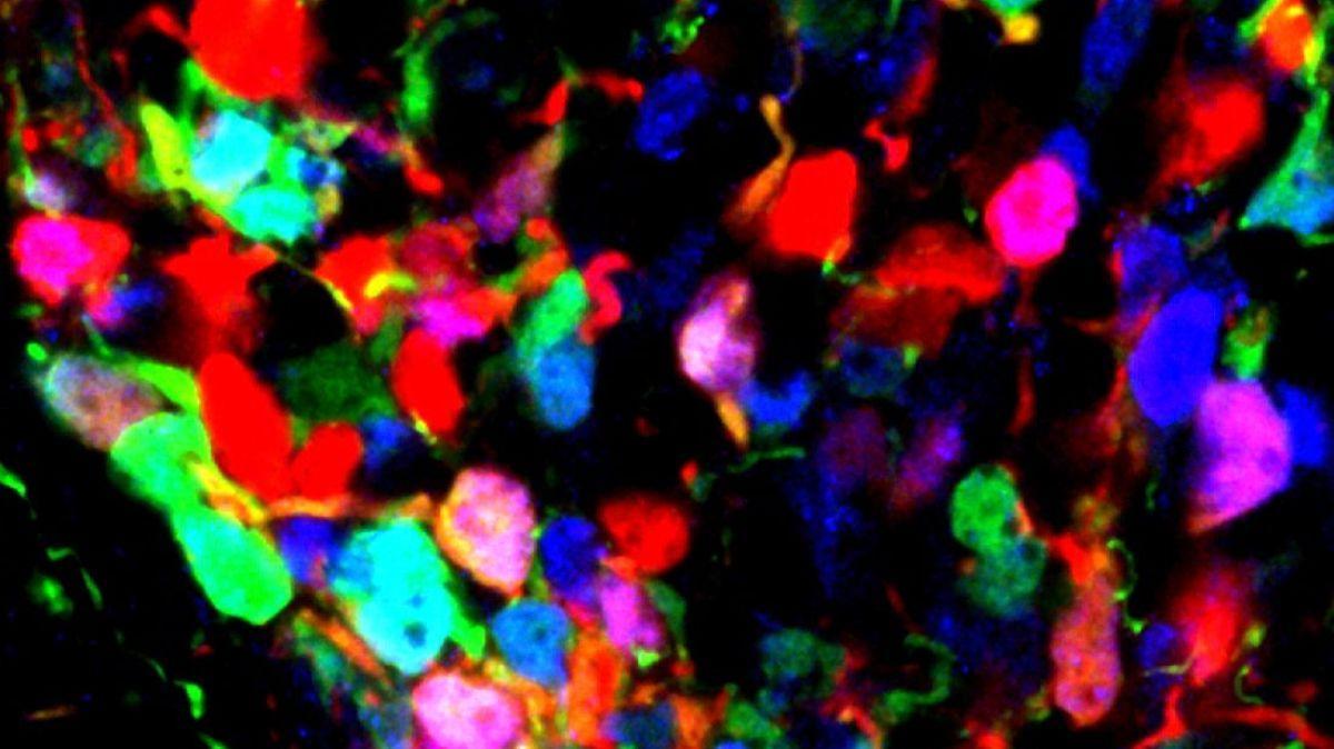 Cambios en el hipotálamo en desarrollo aumentan la predisposición a la obesidad.