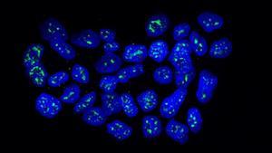 amadridejos41736320 sociedad investigacion irb barcelona  roger gomis  nucleos d180122191210