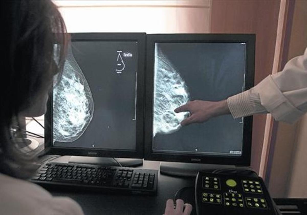 Una exploració mitjançant tomosíntesi o mamografia en 3D per detectar càncers de mama.