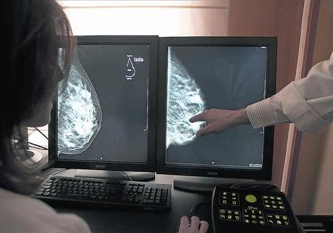 Una exploració mitjançant tomosíntesi o mamografia en 3D per detectar càncers de mama.