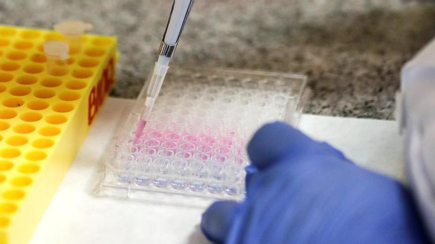 Galicia únese á carreira mundial na procura da vacina contra o Covid-19