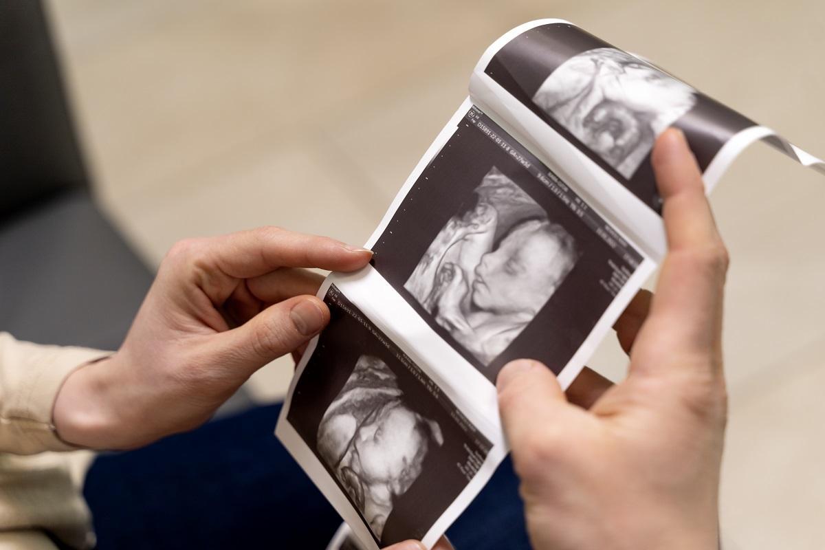 A mayor peso más dificultades para detectar problemas en el feto en las ecografías.