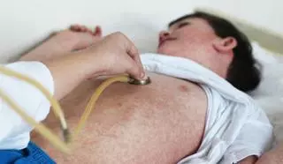 ¿Qué es el sarampión y cuáles son sus síntomas?