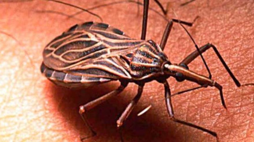 La Arrixaca atiende el mayor número de pacientes de Chagas del mundo