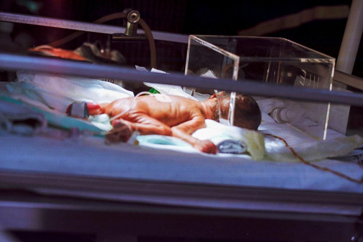 Niveles elevados de cortisol están relacionados con partos prematuros y un menor peso de los bebés.