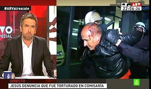 Xesús Pinto, dirigent sindical, després de ser colpejat (’Al rojo vivo’).