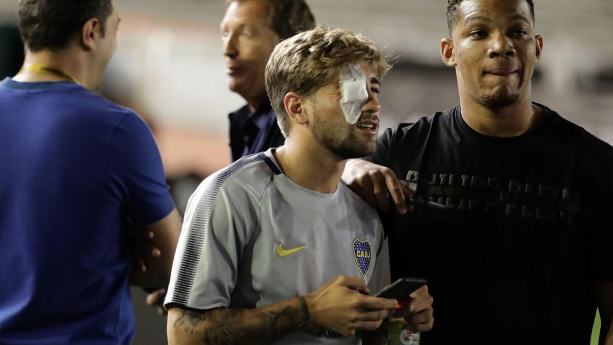 Gonzalo Lamardo, uno de los jugadores del Boca que ha resultado herido en el ataque al bus del equipo.