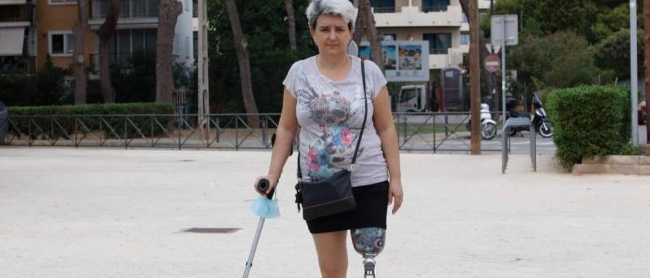«El día que me amputaron la pierna volví a nacer»