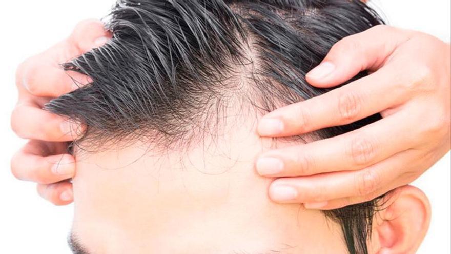 Este gel de Mercadona frena la caída del pelo y fortalece las raíces