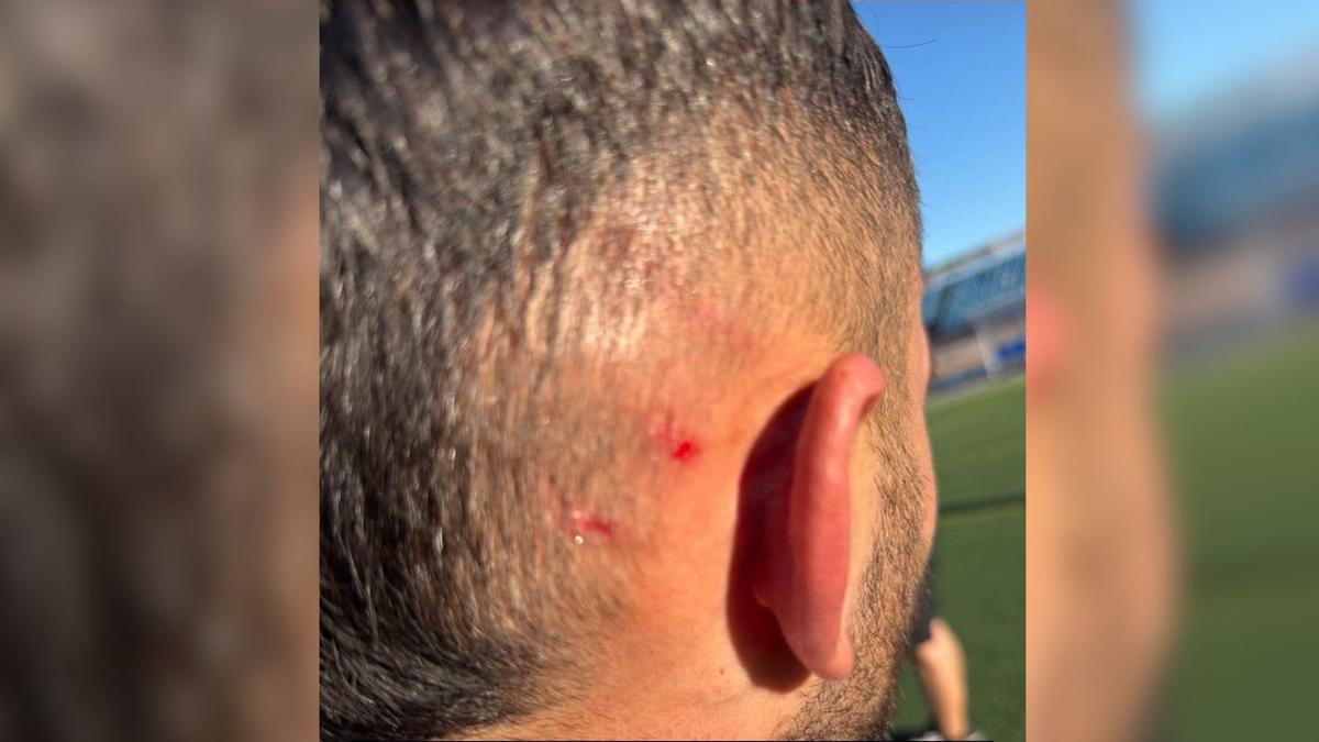 El jugador del CD Badajoz, José Manuel Bermúdez 'Bermu', asegura que un aficionado del Jaraíz le agredió este domingo.