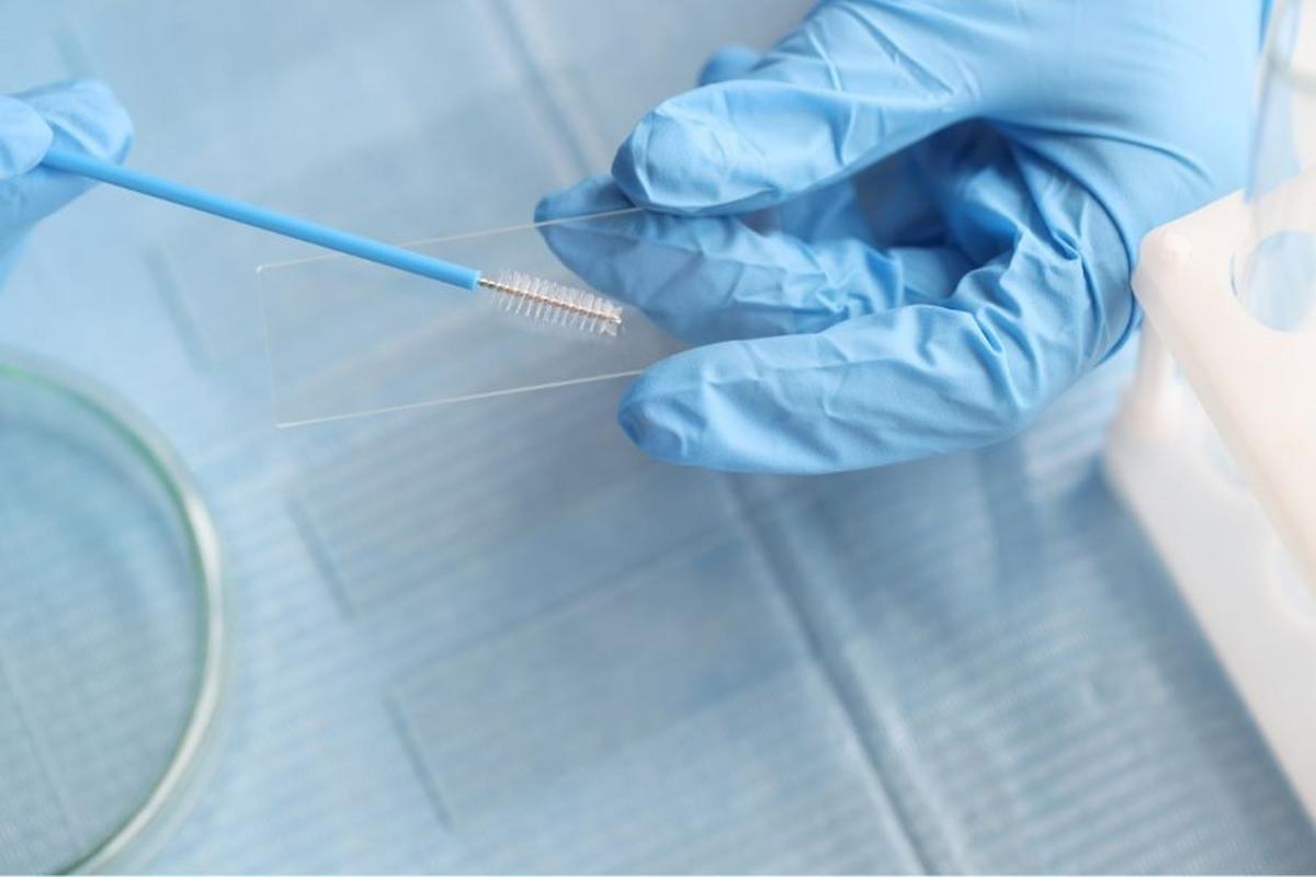 Imagen de una prueba de cáncer de útero.