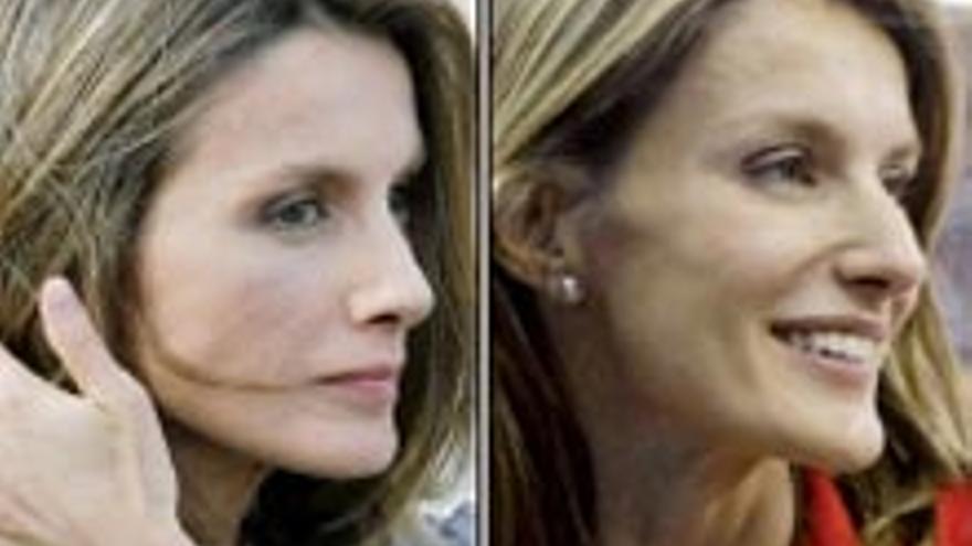 ¿Rinoplastia o septoplastia? ¿Qué se ha hecho Letizia?