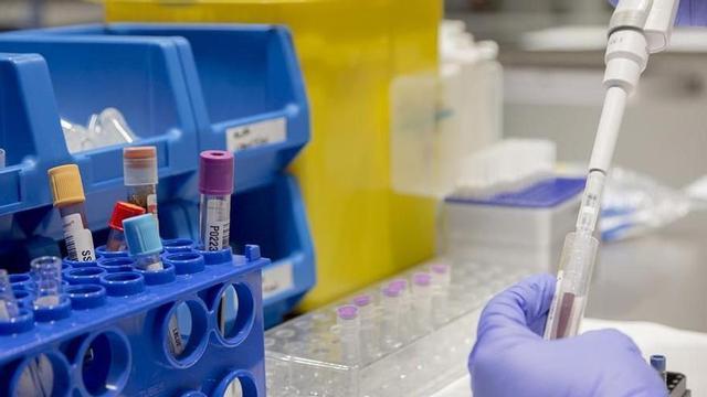 Biomarcadors d’Alzheimer en una mostra de sang. | FUNDACIÓ PASQUAL MARAGALL