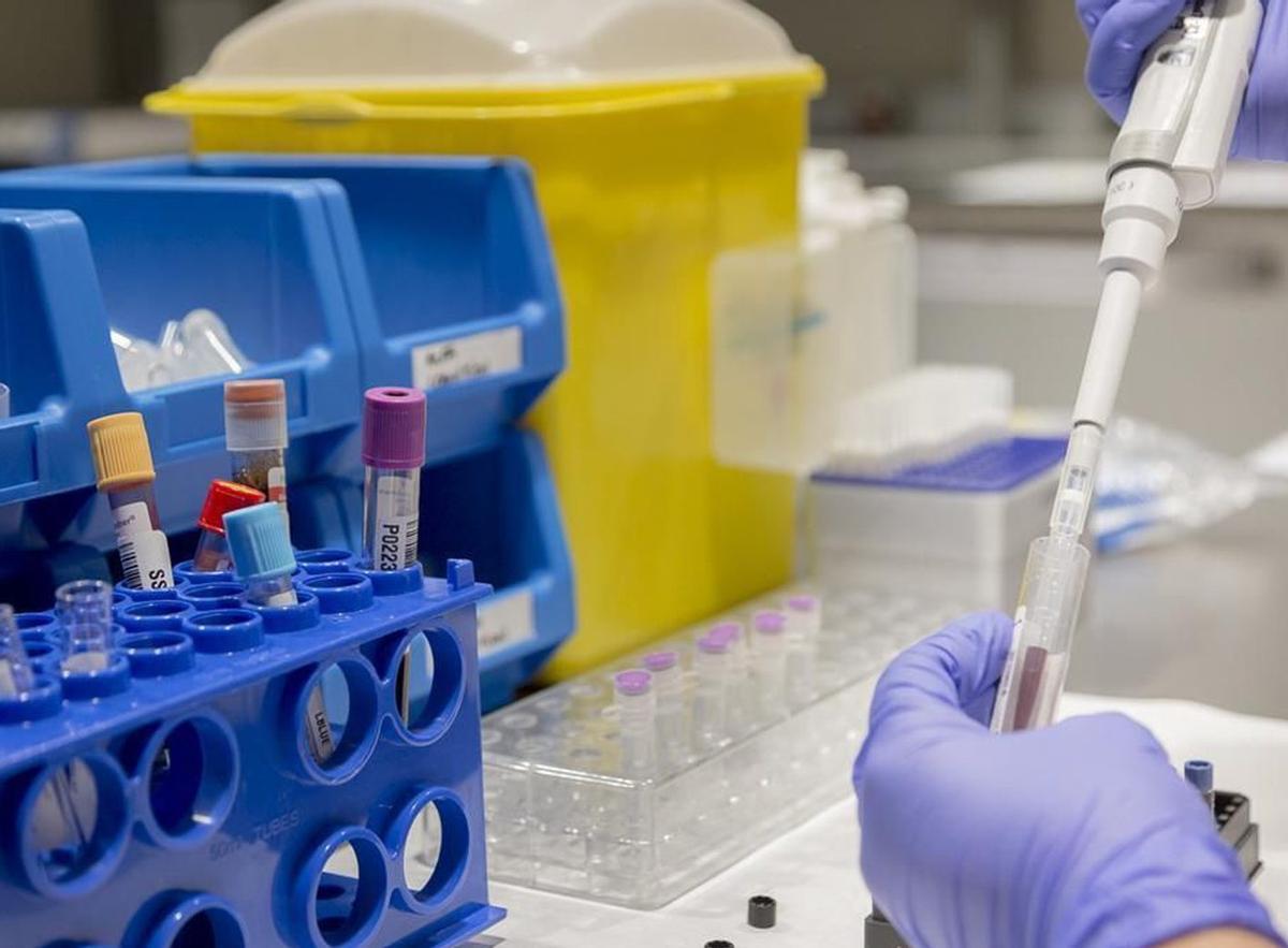 L’èxit dels tests de l’Alzheimer accelera l’assaig en proves per a altres demències