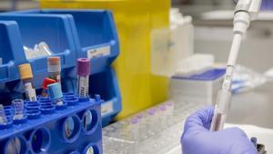 L’èxit dels tests de l’Alzheimer accelera l’assaig en proves per a altres demències